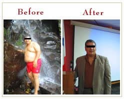 Slider image (8) Panama Gastric Surgery Center